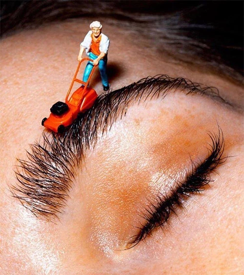 Permanent hair removal for a better quality of life.